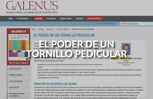 El Poder del Tornillo Pedicular